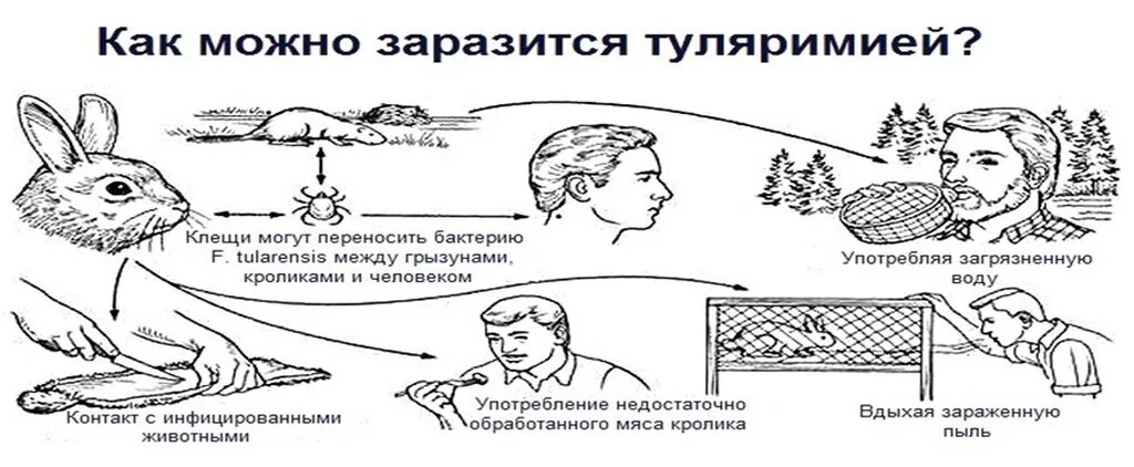 картинка туляремия