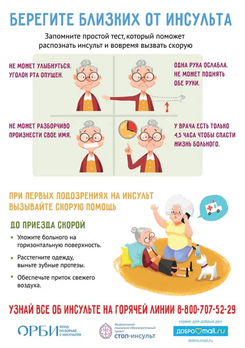 Признаки инсульта для населения
